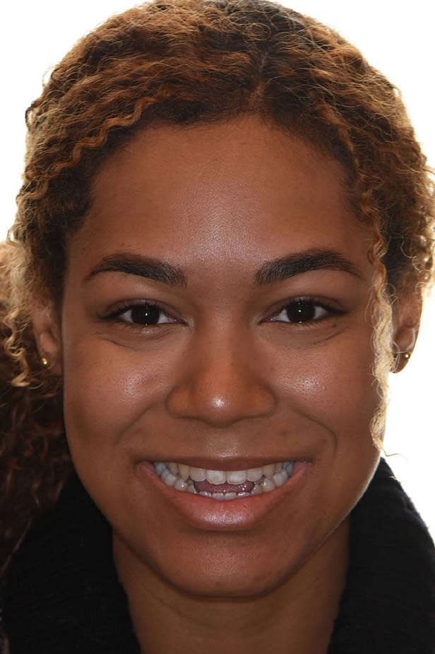 invisalignsurgery-full-face1